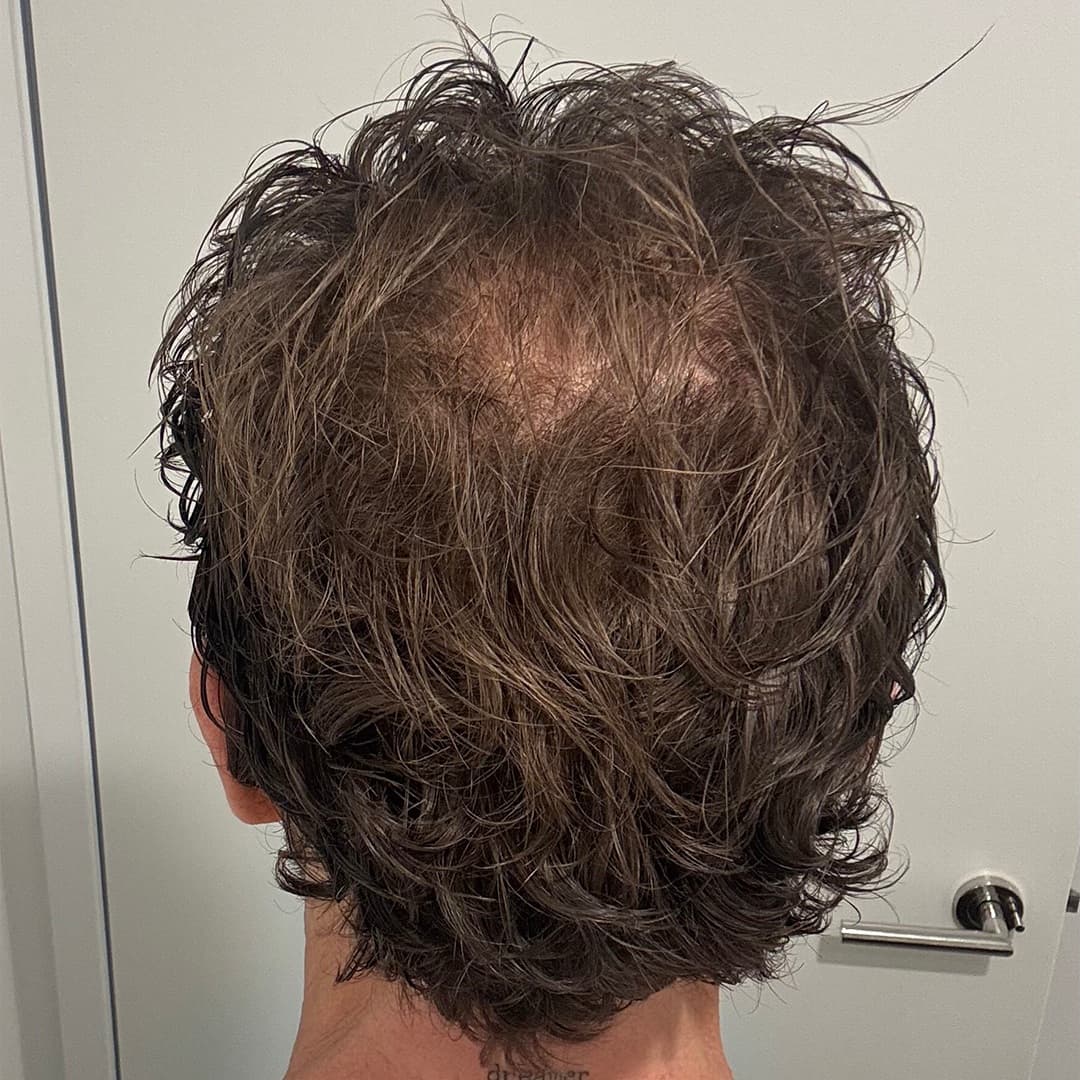 Carl after