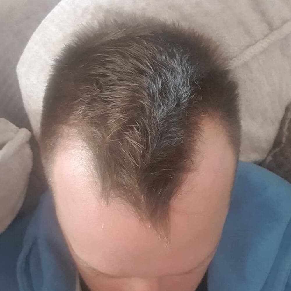 Tom before